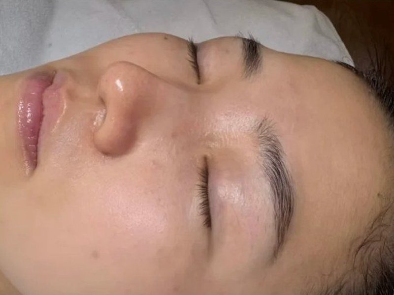 After &mdash; Dark skin &rarr; Brighter skin