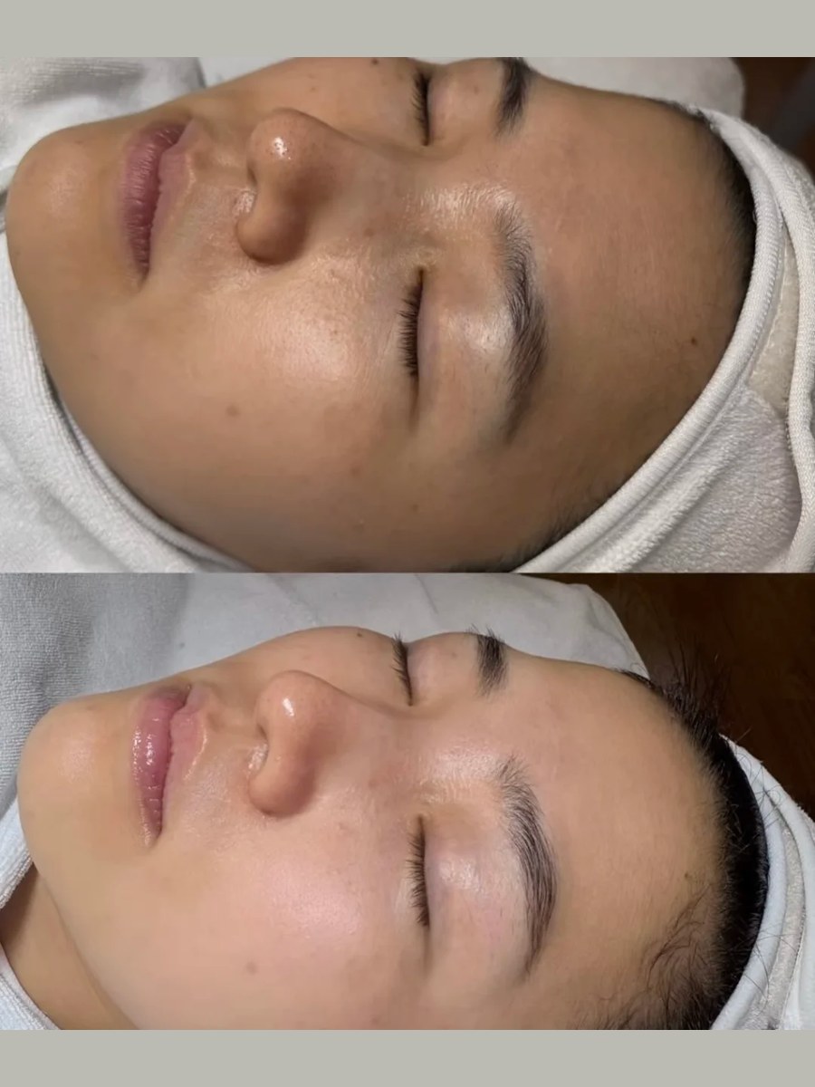Before and after