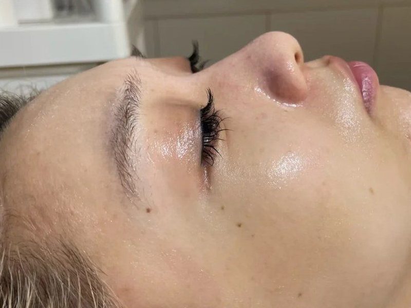 After &mdash; Even & Luminous Tone