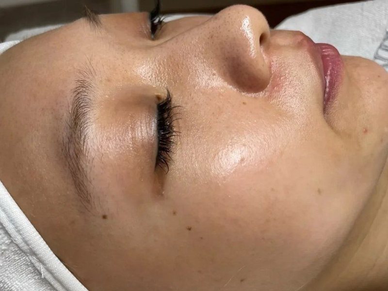 Before &mdash; Even & Luminous Tone