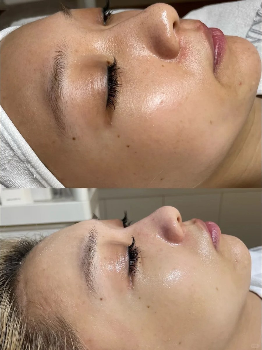 Before and after