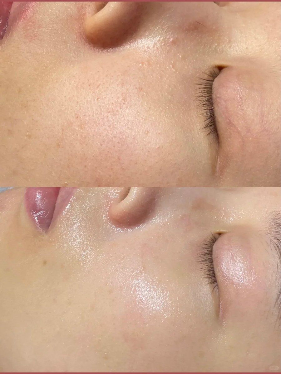 Before and after