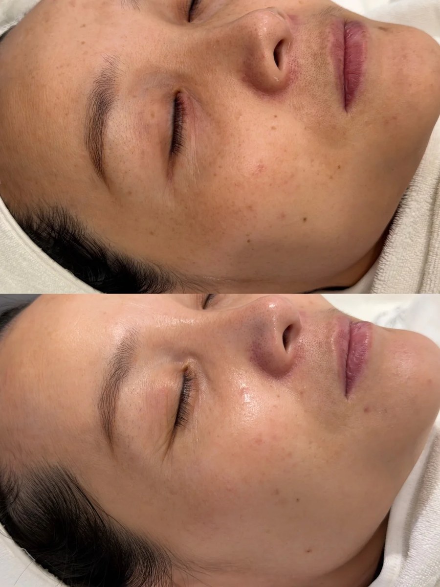 Before and after