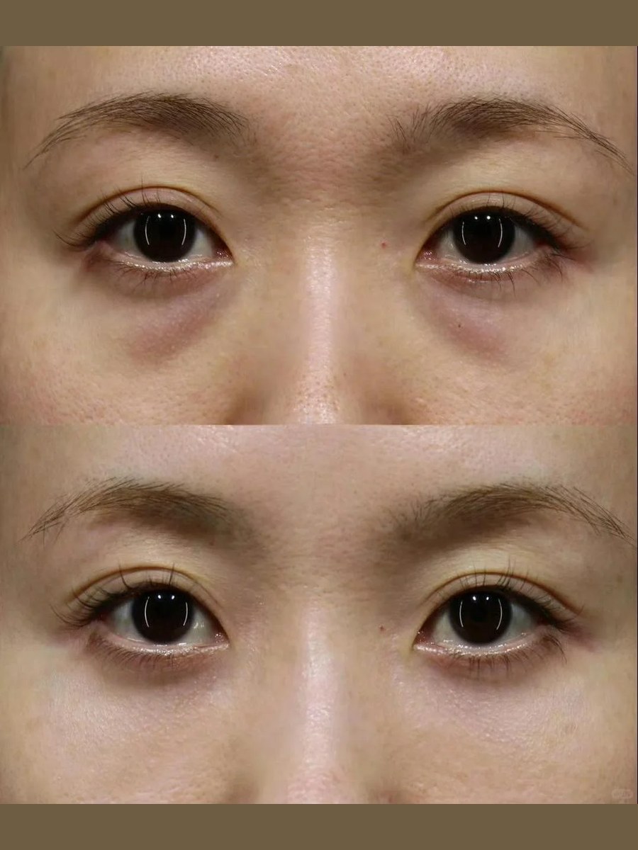 Before and after