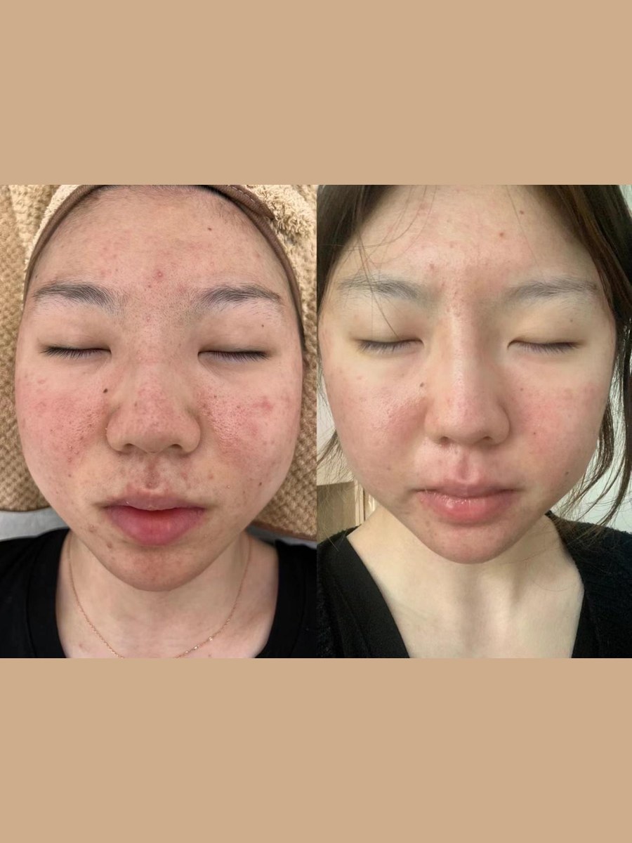 Before and after