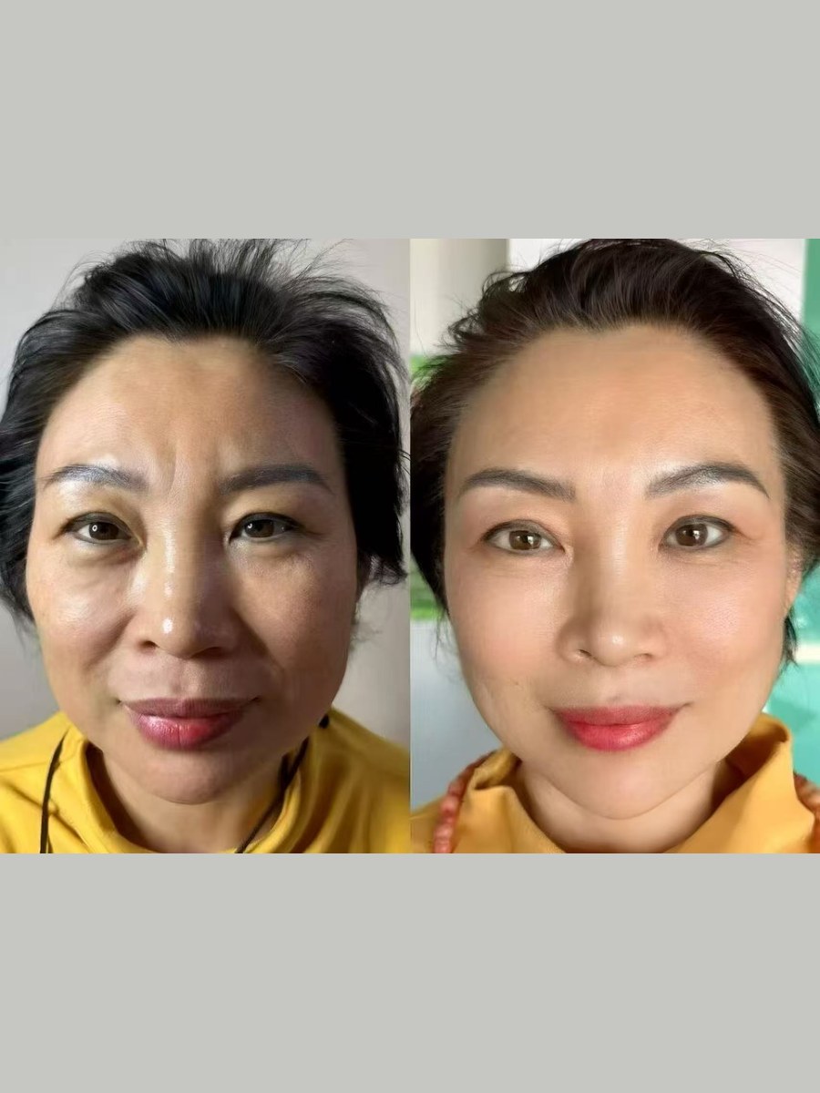 Before and after